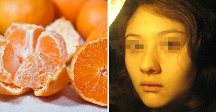 Hội chứng thừa carotene gây vàng da khi ăn quýt có nguy hiểm đến sức khỏe của bạn không?