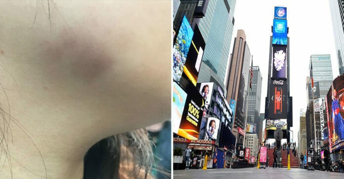COVID-19: Sinh viên Hàn ở New York bị đánh vì không đeo khẩu trang