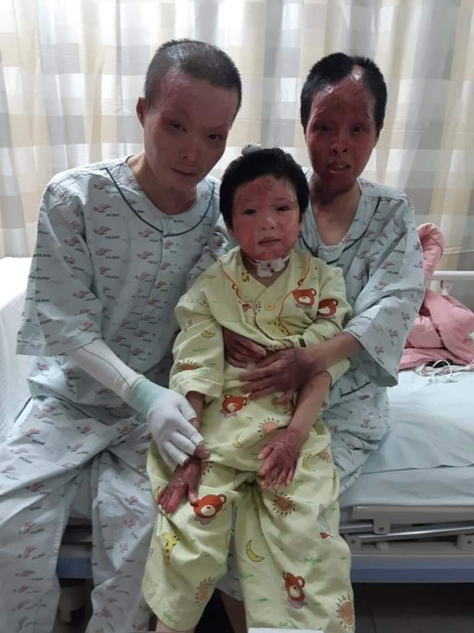 Người Việt ở Hàn & Tấm lòng tương trợ gia đình cô dâu Việt bị tai nạn vì hỏa hoạn