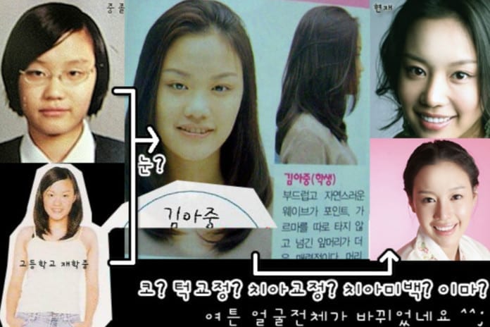 Diễn viên Kim Ah Joong và scandal PTTM.