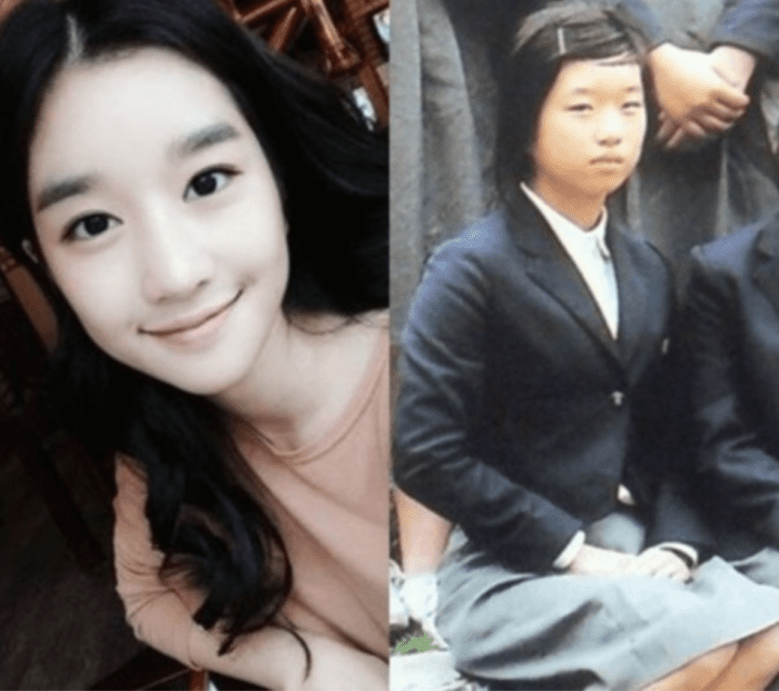 Seo Ye Ji của hiện tại (trái) và hình ảnh được cho là của cô khi còn là học sinh (phải) khi chưa PTTM.
